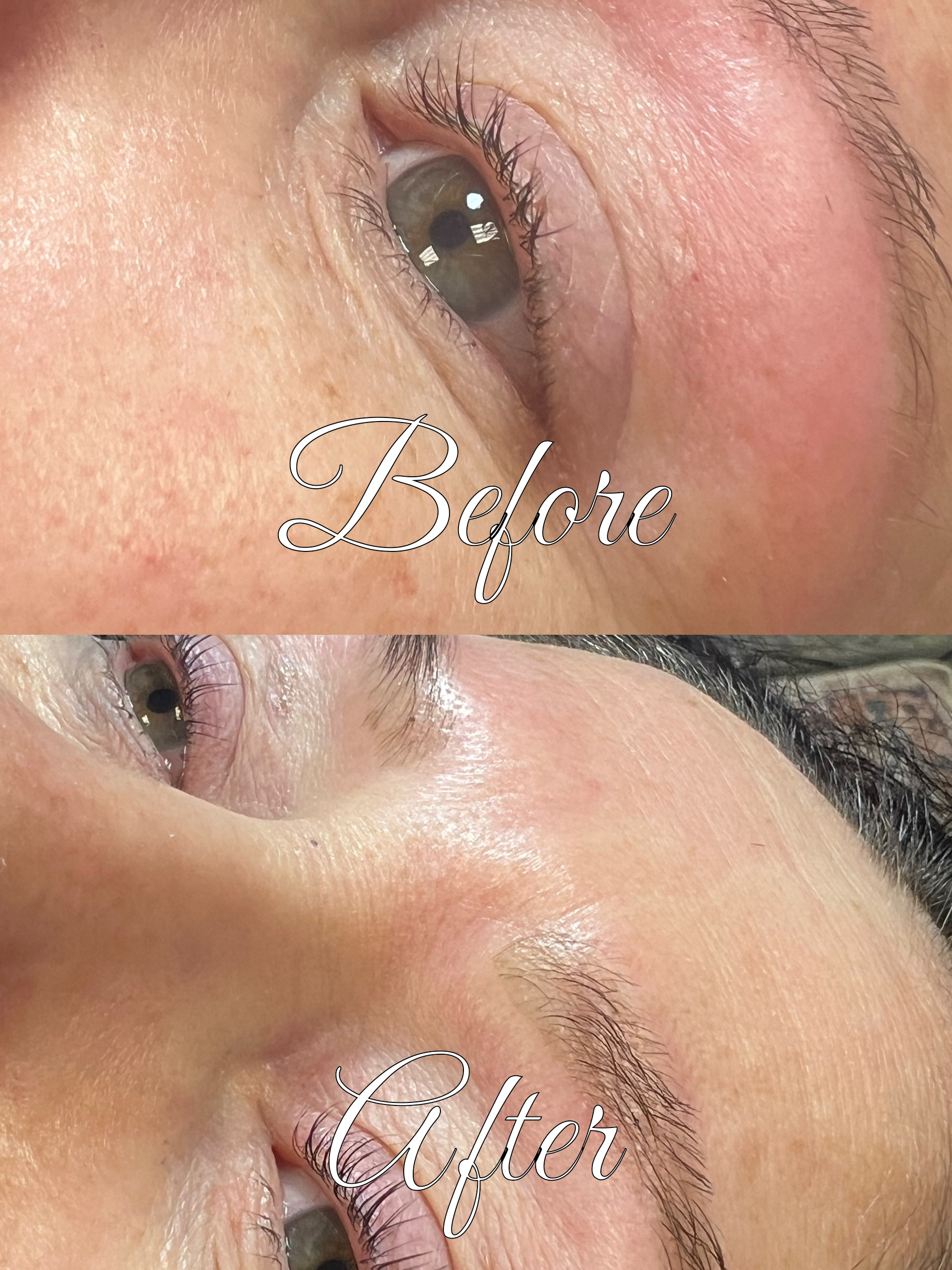 Before and After Transformation